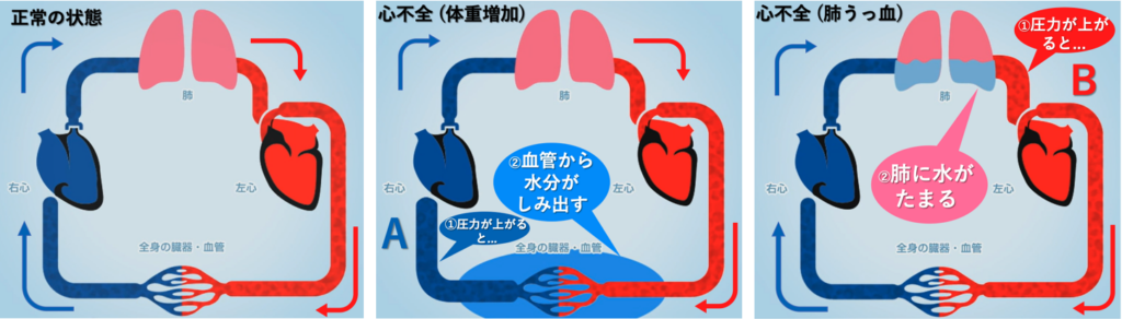 心不全は症候群